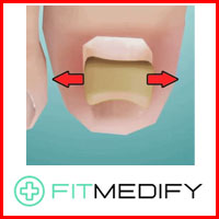 Fitmedify Toenail Patches